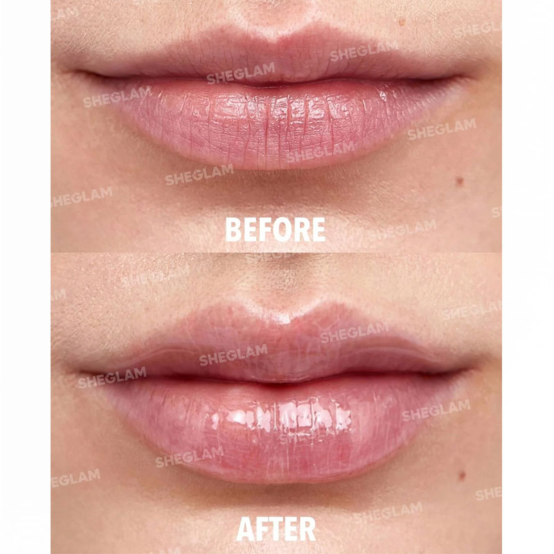 kadolin-image-g-005609