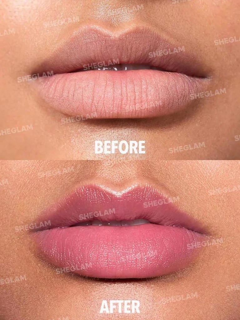 kadolin-image-g-007889