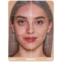 kadolin-image-g-010483